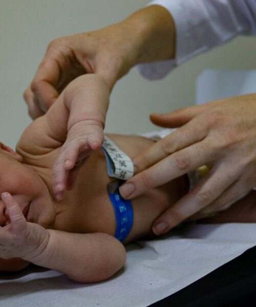 Teste do Olhinho, realizado nos hospitais estaduais, agora é obrigatório em toda a rede de saúde de SC