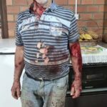 Homem é atacado por Puma em Maquiné
