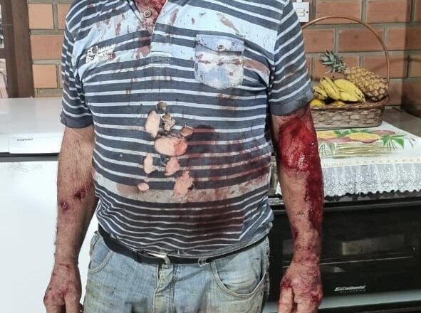 Homem é atacado por Puma em Maquiné