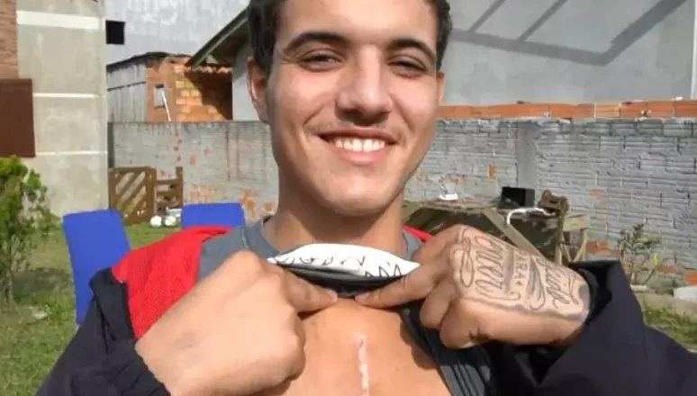Jovem de Passo de Torres escapa da morte após ter prego cravado no peito: ‘Foi um milagre’