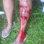 URGENTE: Cães continuam atacando turistas na praia em Passo de Torres