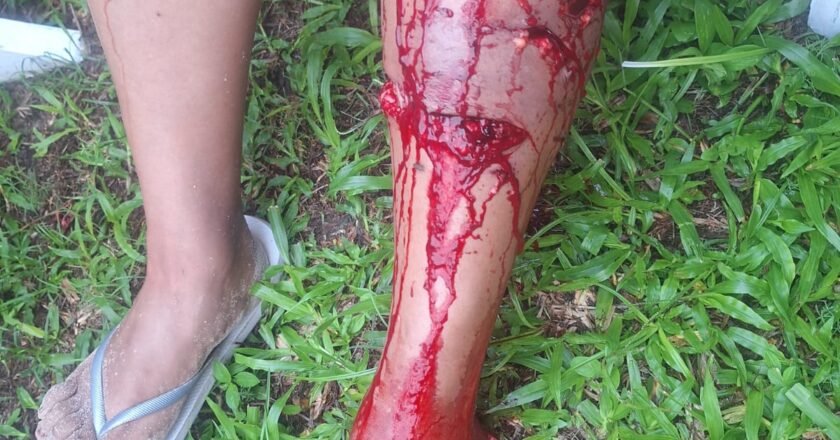 URGENTE: Cães continuam atacando turistas na praia em Passo de Torres