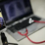 Procura pela telemedicina cresce, mas setor ainda enfrenta desafios